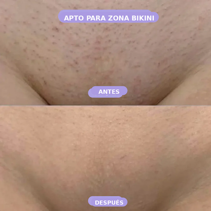 Smooth - Spray depilatorio corporal